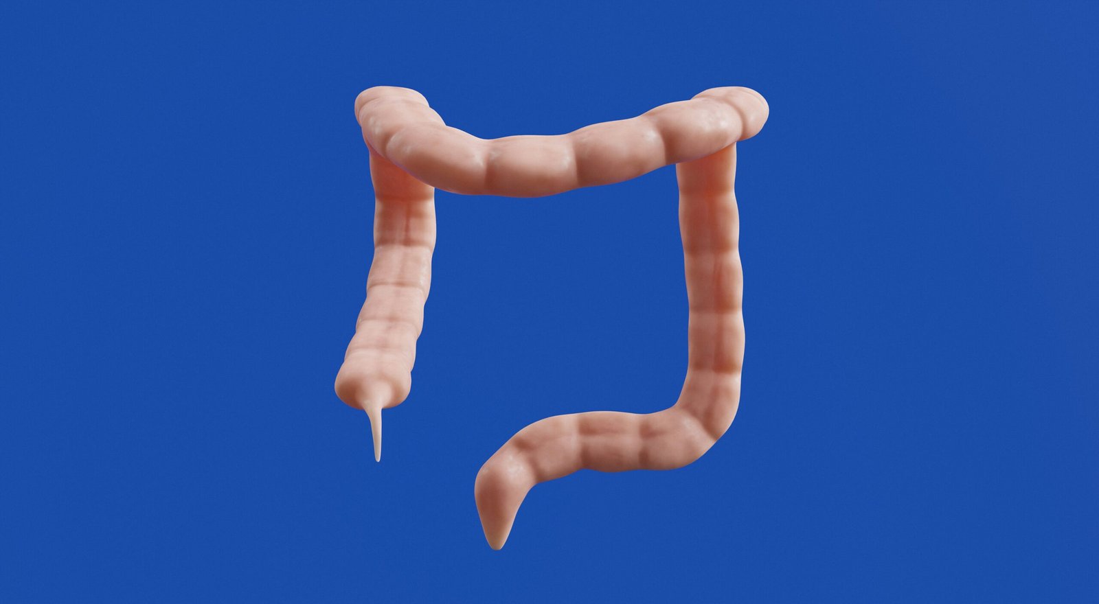 The image shows a 3D model of a colon.