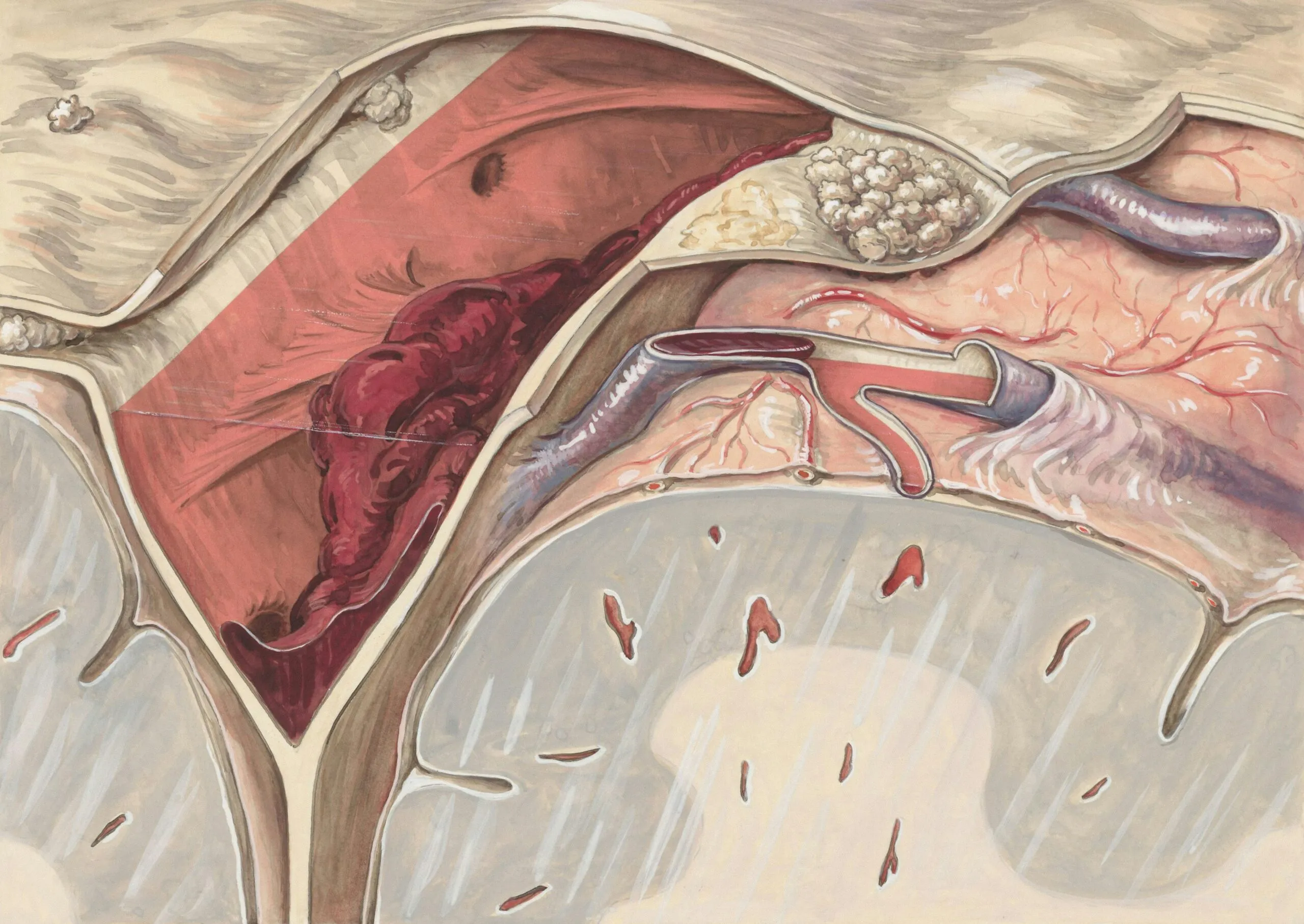 Title: Sick human tissue relating to thrombosis Creator: Wetselaar-Whittaker, J Date: 1950/1990 Providing institution: Leiden University Libraries Aggregator: Dutch Collections for Europe Providing Country: Netherlands Public Domain Sick human tissue relating to thrombosis by Wetselaar-Whittaker, J - Leiden University Libraries, Netherlands - Public Domain. https://www.europeana.eu/item/744/item_3461894