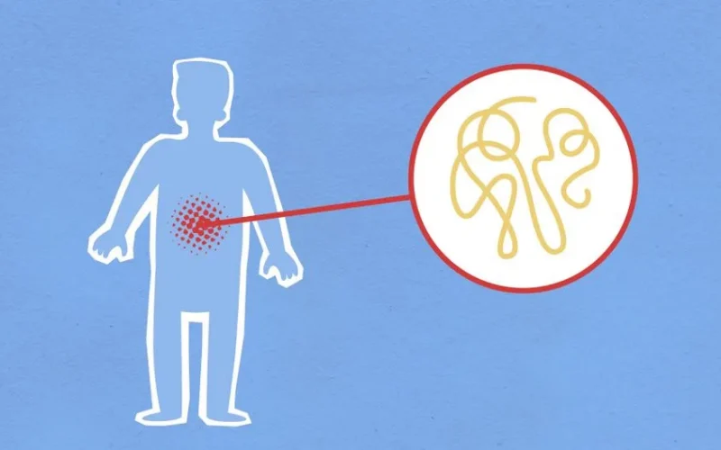 Cutout paper composition representing sick human figure with viral infection in stomach on blue background