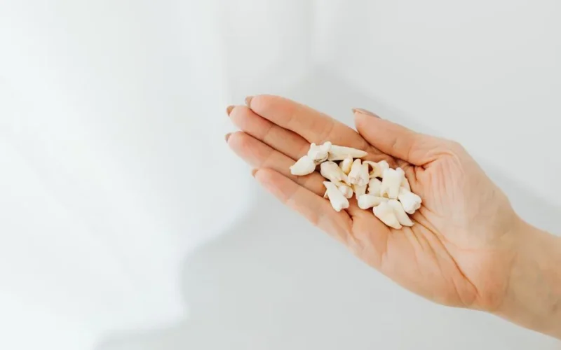 A close-up shot of a hand holding loose human teeth on a white background.