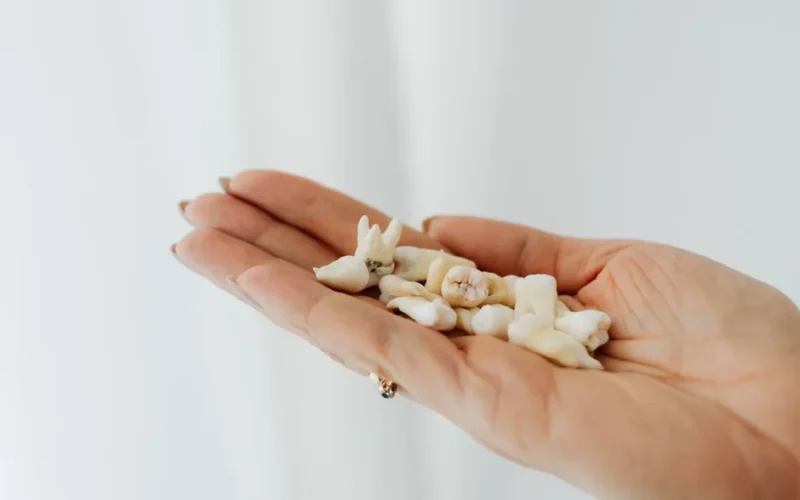 Close-up image of human teeth held in a hand, set against a white background.