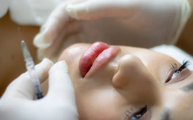 Close-up of a woman receiving a lip augmentation with a syringe by a professional.
